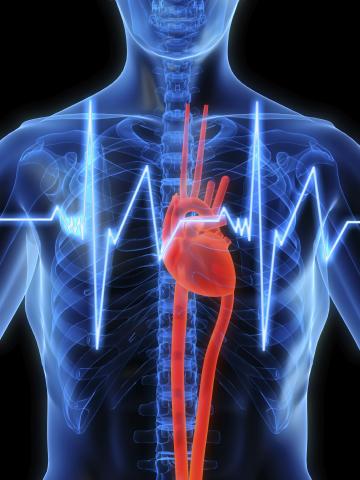 Heart X-Ray